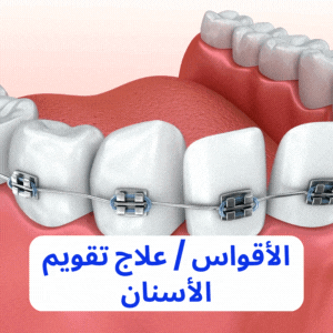 best dental implants in mumbai